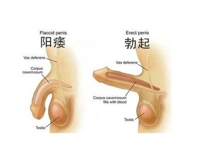 阳痿的症状和解决方法