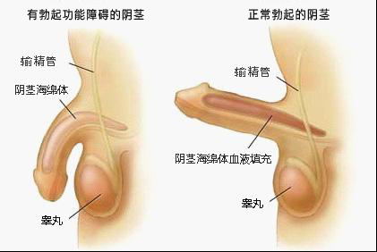 道县治疗勃起障碍哪家医院比较好